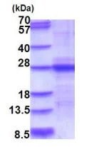 SDS-PAGE - Recombinant Mouse IL-6 protein (denatured) (His tag N-Terminus) (AB187460)