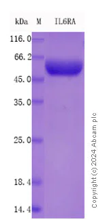 SDS-PAGE - Recombinant Mouse IL-6 R alpha Protein Standard (His tag) (AB316471)