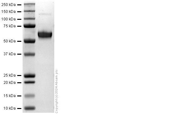SDS-PAGE - Recombinant Mouse IL-9 Protein (Fc Chimera) (AB322316), expandable thumbnail