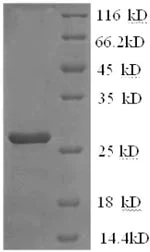 SDS-PAGE - Recombinant Mouse IL2 Receptor beta/p75 protein (His tag) (AB226879)