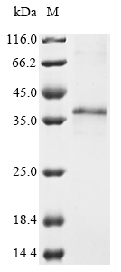SDS-PAGE - Recombinant Mouse ITM2A protein (AB289757)