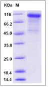 SDS-PAGE - Recombinant Mouse K Cadherin/CDH6 protein (His tag) (AB276957)