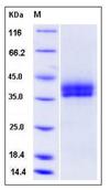 SDS-PAGE - Recombinant Mouse Kallikrein 11 protein (His tag) (AB276939)