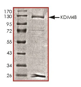 SDS-PAGE - Recombinant Mouse KDM4B / JMJD2B protein (Tagged) (AB268701)