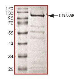 SDS-PAGE - Recombinant Mouse KDM5B / PLU1 / Jarid1B protein (Tagged) (AB268702)