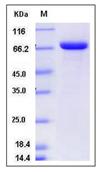SDS-PAGE - Recombinant Mouse Lactoferrin protein (His tag) (AB276922), expandable thumbnail
