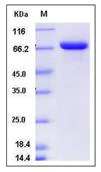 SDS-PAGE - Recombinant Mouse Lactoferrin protein (His tag) (AB276922)