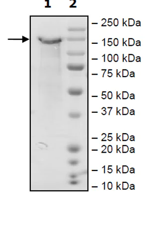 SDS-PAGE - Recombinant Mouse LDL Receptor protein (DDDDK tag C-Terminus + Avi tag C-Terminus) (AB271586)