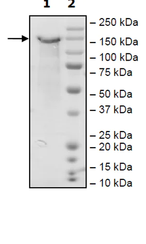 SDS-PAGE - Recombinant Mouse LDL Receptor protein (Tagged) (AB271586)