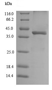 SDS-PAGE - Recombinant Mouse Legumain protein (His tag) (AB235559), expandable thumbnail