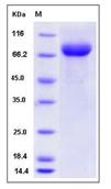 SDS-PAGE - Recombinant Mouse LILRB3 protein (His tag) (AB276923)