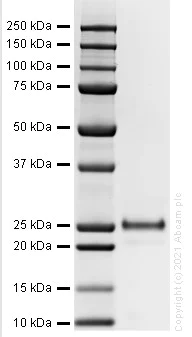 SDS-PAGE - Recombinant Mouse Lipocalin-2 / NGAL protein (Active) (AB282399)