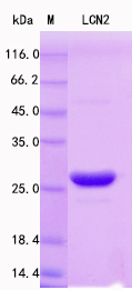 Recombinant Mouse Lipocalin-2 Protein Standard (His tag)