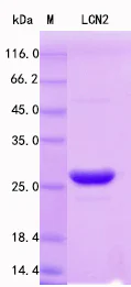 SDS-PAGE - Recombinant Mouse Lipocalin-2 Protein Standard (His tag) (AB316381)