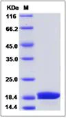SDS-PAGE - Recombinant Mouse Lithostathine-2 protein (His tag) (AB276993)