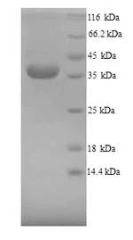 SDS-PAGE - Recombinant Mouse Liver Arginase protein (His tag) (AB226884)