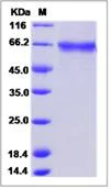 SDS-PAGE - Recombinant Mouse LRRTM4 protein (His tag) (AB276944)