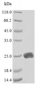 SDS-PAGE - Recombinant Mouse LTA protein (His tag) (AB235554)