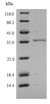 SDS-PAGE - Recombinant Mouse Ly6c protein (Tagged) (AB240852)