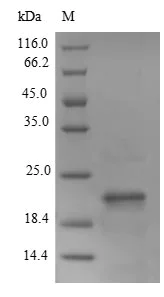 SDS-PAGE - Recombinant Mouse LY6E/SCA-2 protein (Tagged) (AB238240)
