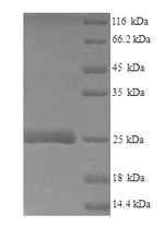 SDS-PAGE - Recombinant Mouse LY6E/SCA-2 protein (Tagged) (AB241269)
