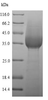 SDS-PAGE - Recombinant Mouse Ly6g protein (His tag) (AB241265)