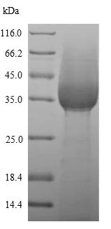 SDS-PAGE - Recombinant Mouse Ly6g protein (His tag) (AB241265)