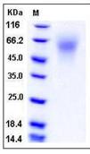 SDS-PAGE - Recombinant Mouse LYPD3 protein (His tag) (AB276870), expandable thumbnail