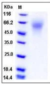 SDS-PAGE - Recombinant Mouse LYPD3 protein (His tag) (AB276870)