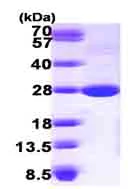 SDS-PAGE - Recombinant Mouse Lysophospholipase 1/LPL-I protein (His tag N-Terminus) (AB101156)