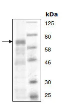 SDS-PAGE - Recombinant mouse MAP3K8/COT protein (His tag N-Terminus + GST tag N-Terminus) (AB196418)