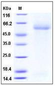 SDS-PAGE - Recombinant Mouse MARCO protein (His tag) (AB276806)