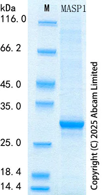 SDS-PAGE - Recombinant Mouse MASP1 Protein Standard (His tag) (AB323822)