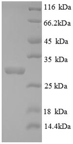 Recombinant Mouse Mast Cell Tryptase protein (His tag)