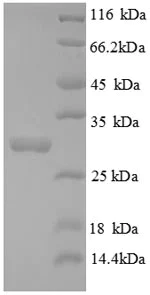 SDS-PAGE - Recombinant Mouse Mast Cell Tryptase protein (His tag) (AB236929)