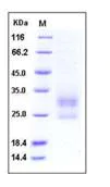 SDS-PAGE - Recombinant Mouse MD1 protein (His tag) (AB276760)