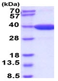Recombinant mouse MDH2 protein (Active)