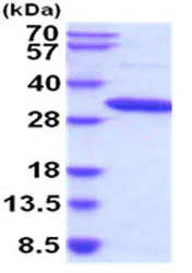 SDS-PAGE - Recombinant Mouse Meteorin protein (His tag C-Terminus) (AB208299)