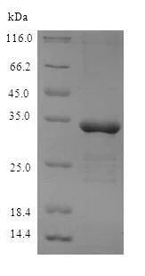 SDS-PAGE - Recombinant Mouse METRNL protein (His tag) (AB239537)
