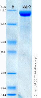 SDS-PAGE - Recombinant Mouse MMP-2 Protein Standard (His tag) (AB316594), expandable thumbnail
