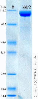 SDS-PAGE - Recombinant Mouse MMP-2 Protein Standard (His tag) (AB316594)