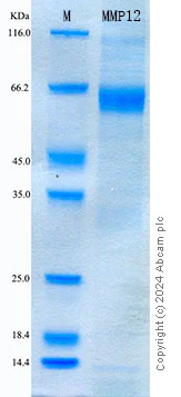 SDS-PAGE - Recombinant Mouse MMP12 Protein Standard (His tag) (AB316590)