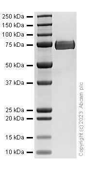 SDS-PAGE - Recombinant Mouse MMP2 Protein (AB313693), expandable thumbnail