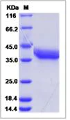 SDS-PAGE - Recombinant Mouse MMP2 protein (His tag) (AB277016)
