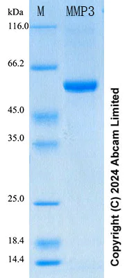 SDS-PAGE - Recombinant Mouse MMP3 Protein Standard (His tag) (AB316654)