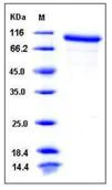 SDS-PAGE - Recombinant Mouse MMP9 protein (AB276873)