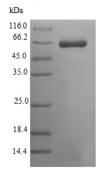 SDS-PAGE - Recombinant Mouse MUSK protein (Tagged) (AB226426), expandable thumbnail