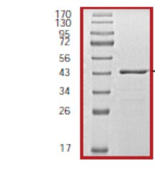 SDS-PAGE - Recombinant Mouse MYL9 protein (AB60014), expandable thumbnail