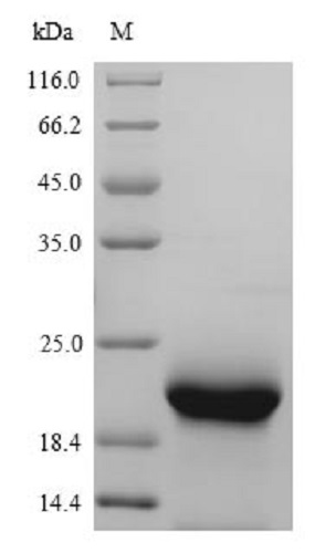 SDS-PAGE - Recombinant Mouse Myoglobin protein (His tag) (AB241238), expandable thumbnail