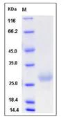 SDS-PAGE - Recombinant mouse NBL1 protein (His tag) (AB276955)